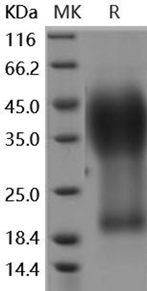 GYPA/CD235a/Glycophorin A Recombinant Protein (RPES3294)