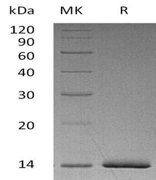 ER alpha Recombinant Protein (RPES3303)