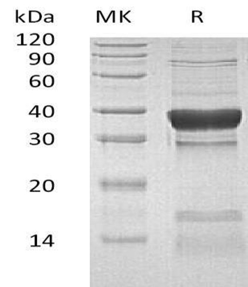 Human PPP1CC Recombinant Protein (RPES3305)