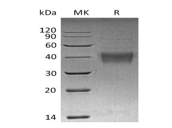 Mouse TNFSF9 Recombinant Protein  (RPES3308)