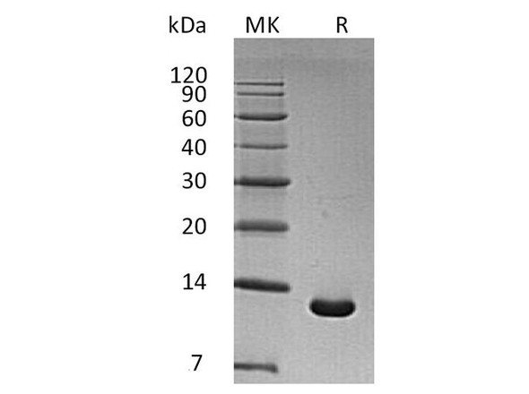 Human S100A6 Recombinant Protein (RPES3311)