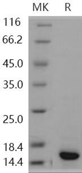 Human S100A9 Recombinant Protein (RPES3315)