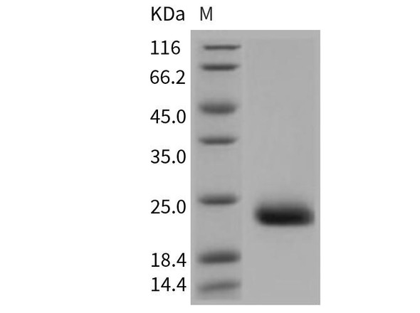 Mouse CLEC6A/Dectin-2 Recombinant Protein (RPES3319)