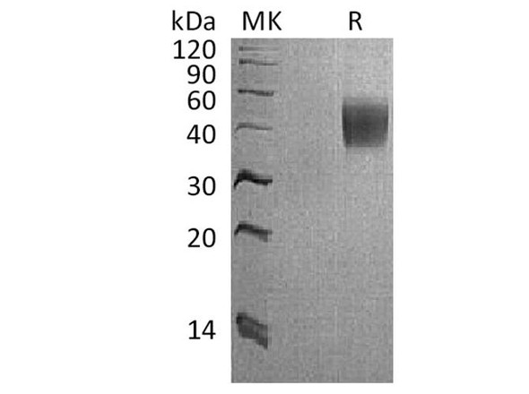 Cynomolgus IL-4 R Alpha Recombinant Protein (RPES3353)