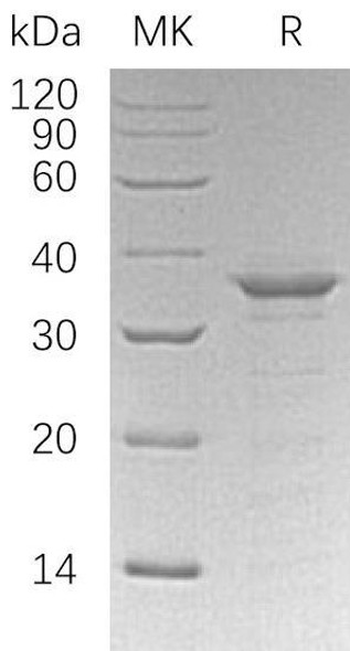 Human ETS1/EWSR2 Recombinant Protein (RPES3363)