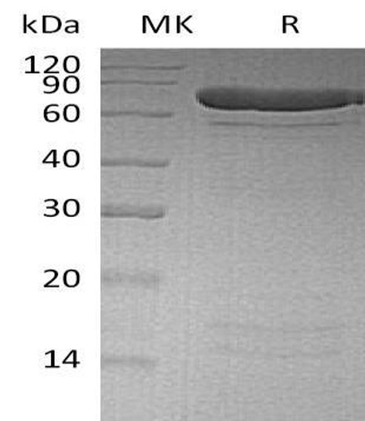 Human PADI4 Recombinant Protein (RPES3365)