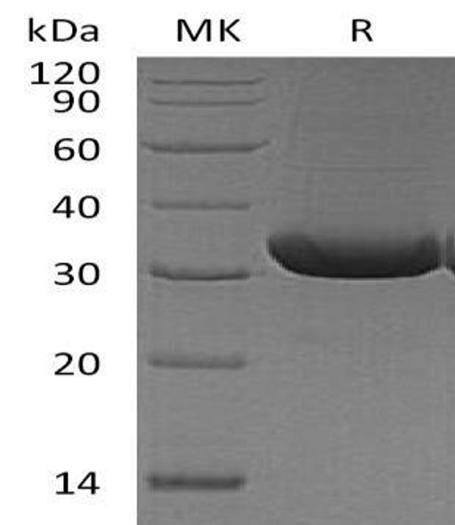 Mouse RANKL/TNFSF11 Recombinant Protein (RPES3368)