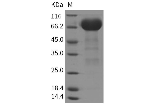 Rat EphA3 Recombinant Protein (RPES3377)