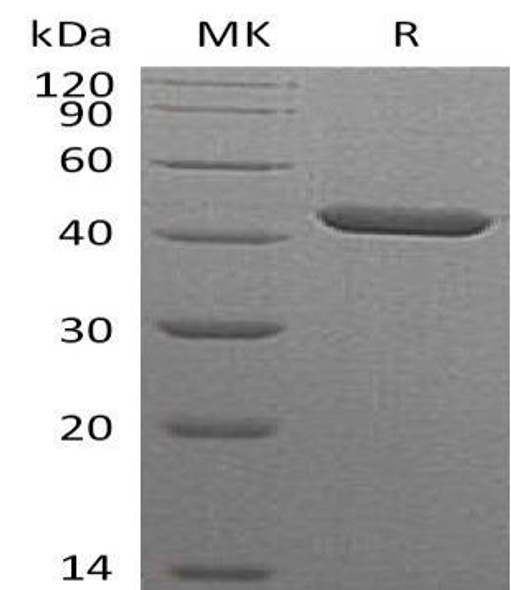Human SERPINB1/PI2 Recombinant Protein (RPES3383)