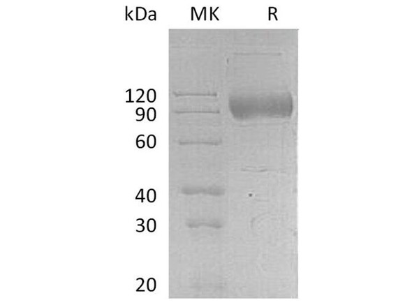 Human IL17RA Recombinant Protein (RPES3390)