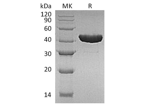 E.coli Trp B Recombinant Protein (RPES3392)