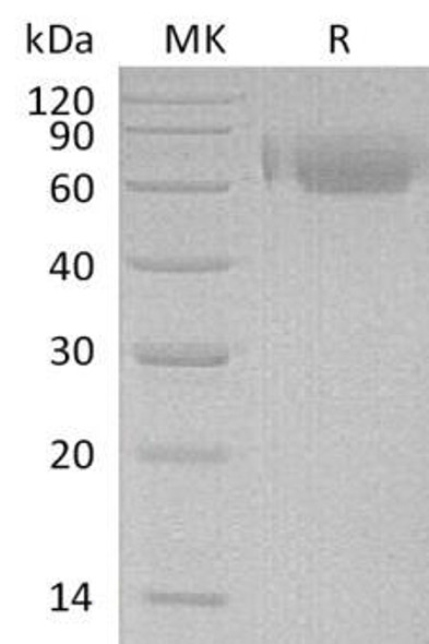 Human LILRA2/ILT1 Recombinant Protein (RPES3402)