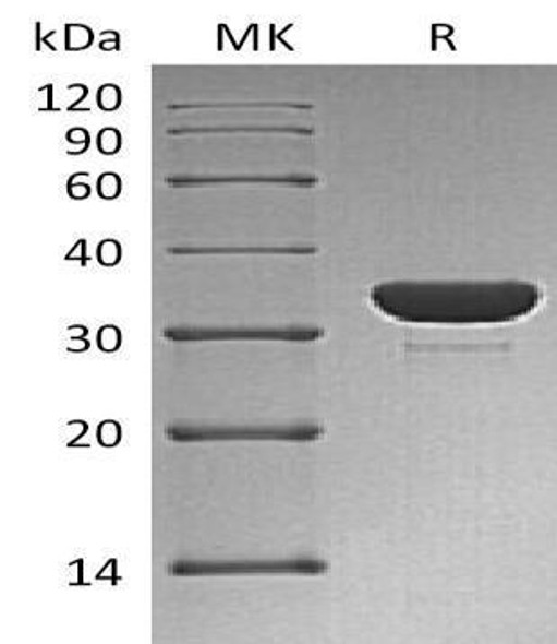 Human PTPN6/SH-PTP1 Recombinant Protein (RPES3403)
