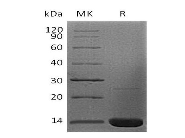 Beta-2-Microglobulin/B2M Recombinant Protein (RPES3404)