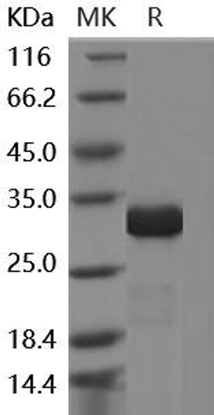 Human IMP1/IMPA1 Recombinant Protein (RPES3412)