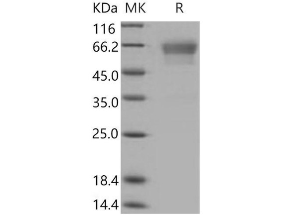 Mouse Podoplanin/PDPN Recombinant Protein (RPES3418)