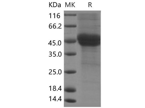 Human Follistatin/FST Recombinant Protein (RPES3439)