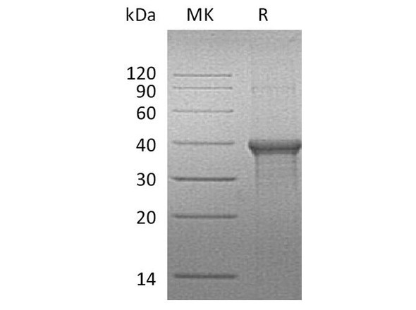 Human BLVRA Recombinant Protein (RPES3440)