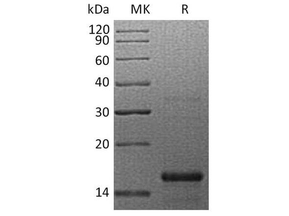 Human GFER Recombinant Protein (RPES3441)