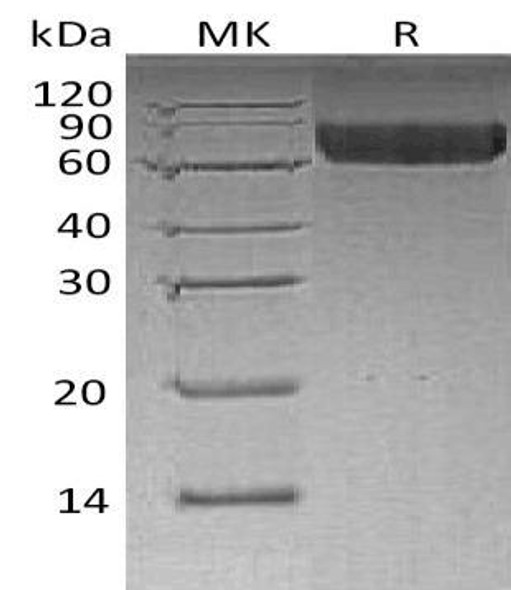 Human LILRB2/CD85d Recombinant Protein (RPES3442)