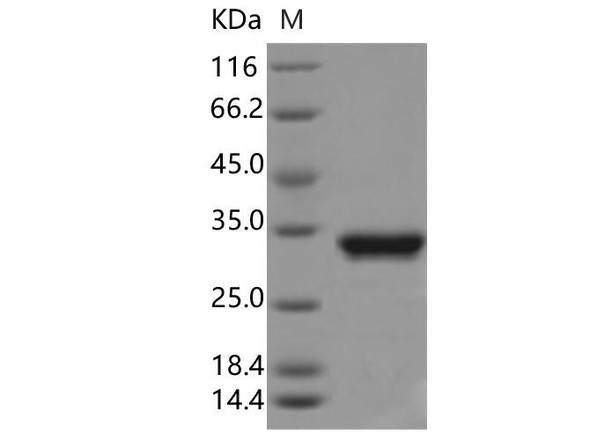 Aequorea victoria GFP Recombinant Protein (RPES3450)