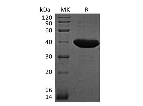 E.coli LacI Recombinant Protein (RPES3452)