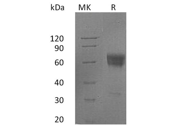 Human FAS/TNFRSF6 Recombinant Protein (RPES3463)