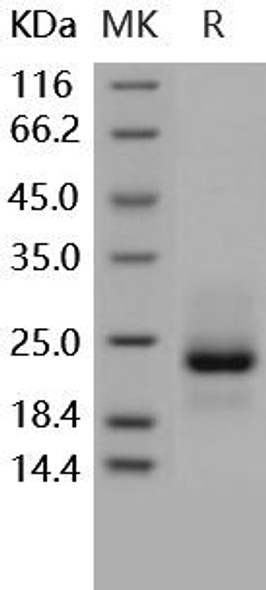Human TRAILR1/TNFRSF10A Recombinant Protein (RPES3477)