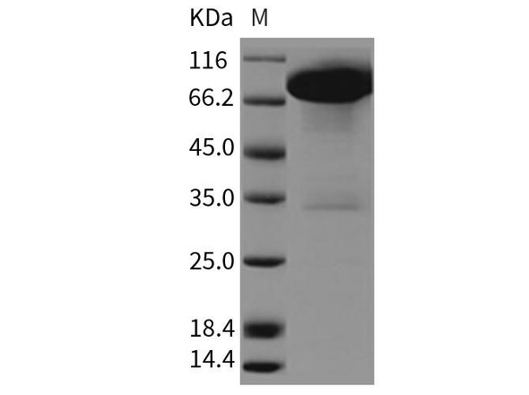 Rat DDR1 Kinase/CD167 Recombinant Protein (RPES3478)