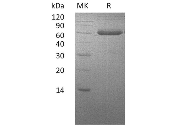 Human BMPRIA/ALK-3 Recombinant Protein (RPES3483)