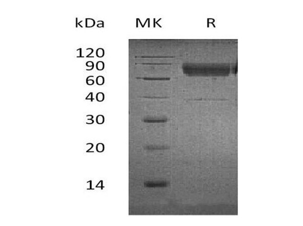 Human CD300a/LMIR1 Recombinant Protein (RPES3485)
