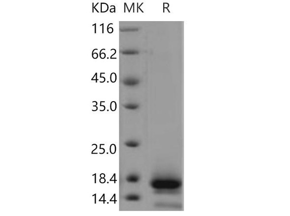 Human TSPAN8/Tetraspanin 8 Recombinant Protein (RPES3495)