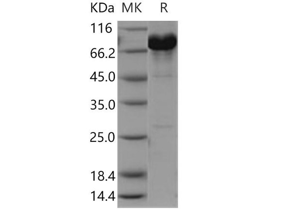 Human NCF2/P67phox Recombinant Protein (RPES3502)