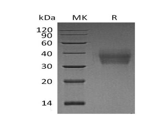 Human LMIR2/CD300C Recombinant Protein (RPES3505)