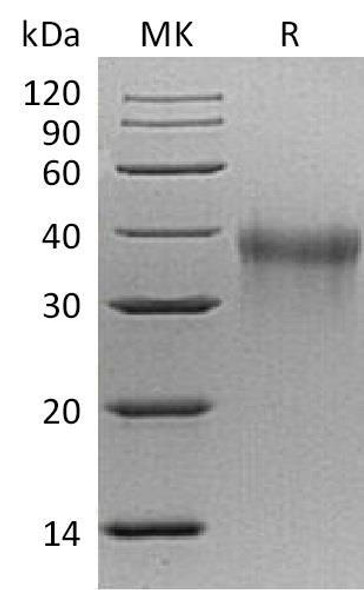 Mouse TREM1 Recombinant Protein (RPES3509)