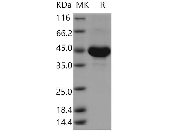 Human TSPAN8/Tetraspanin 8 Recombinant Protein (RPES3515)