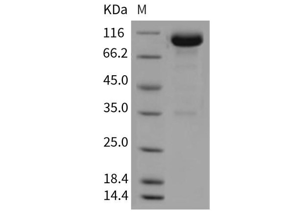 Mouse OBCAM/OPCML Recombinant Protein (RPES3520)