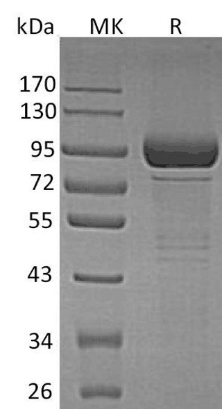 Beta-Galactosidase/GLB1 Recombinant Protein (RPES3548)