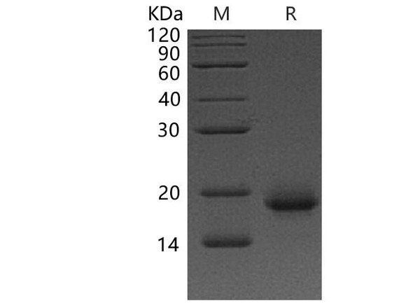 Human Interleukin-4/IL-4 Recombinant Protein  (RPES3551)