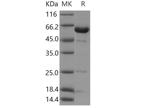Human NCF2/P67phox Recombinant Protein (RPES3557)