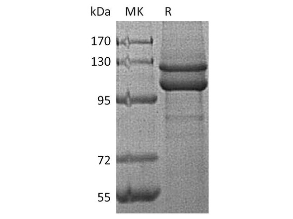 Human E-Cadherin/CDH1 Recombinant Protein (RPES3576)