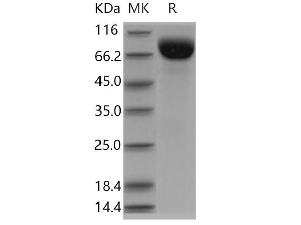 Human Biotinidase/BTD Recombinant Protein (RPES3578)