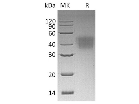 Human CD16a/FCGR3A Recombinant Protein (RPES3588)