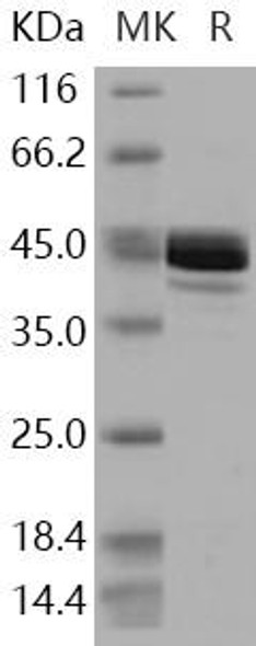 Human Fumarase/FH Recombinant Protein (RPES3599)