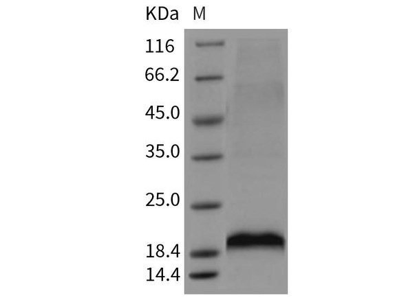 Mouse MANF/ARMET Recombinant Protein (RPES3603)