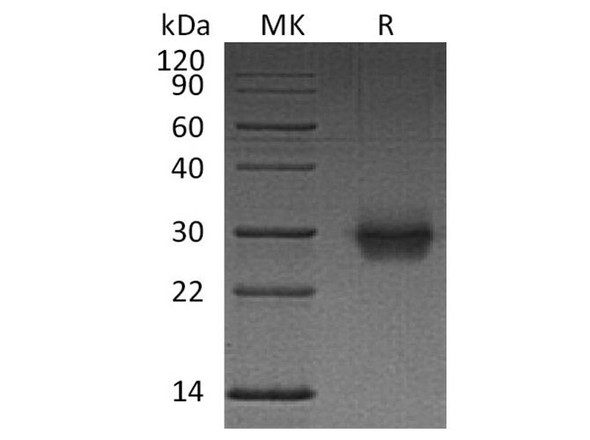 Human CD40/TNFRSF5 Recombinant Protein (RPES3617)