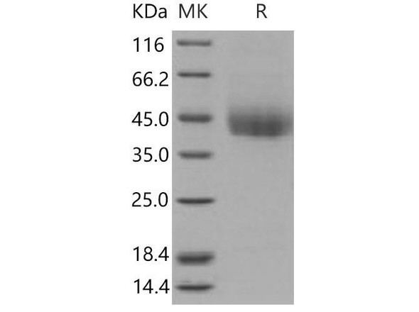 Mouse CD226/DNAM Recombinant Protein (RPES3625)