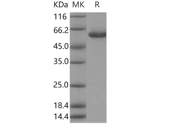 Human Galactolipase/PLRP2 Recombinant Protein (RPES3626)