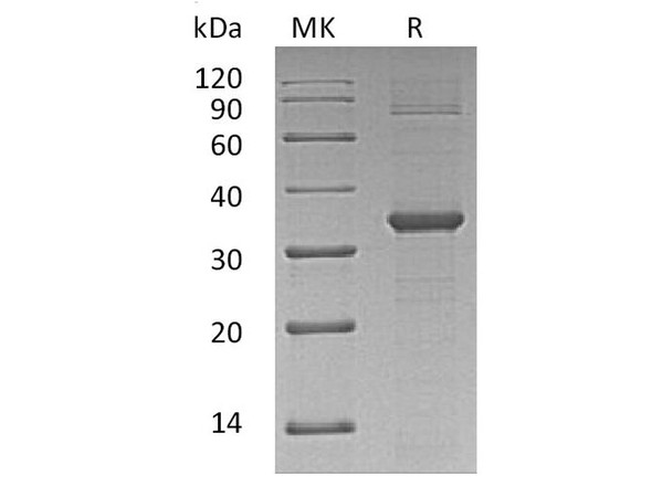 Human CDK2 Recombinant Protein (RPES3637)