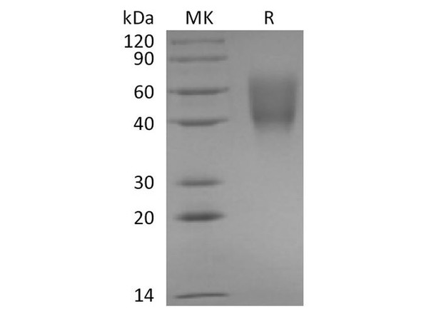 Rabbit B7-2/CD86 Recombinant Protein (RPES3639)